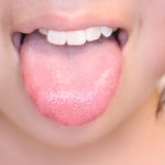 舌でわかる健康！